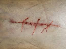 Scar Image